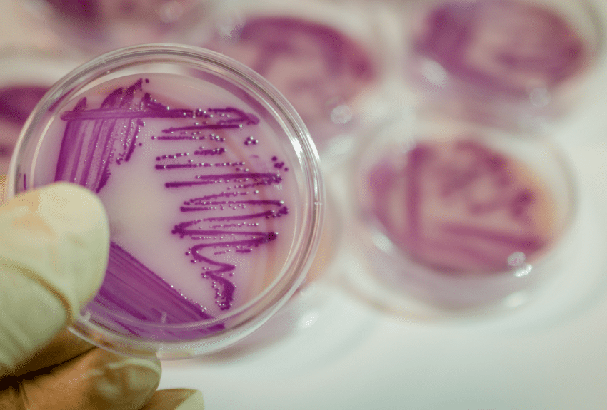 e.coli grown in a petri dish