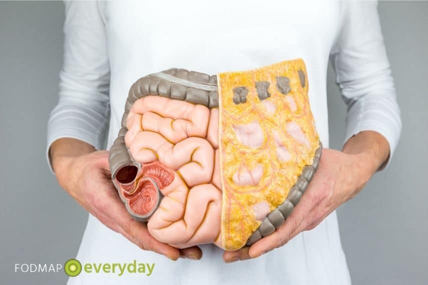 Leaky Gut? What is it and is it real? Woman holding a model of intestines in front of her abdomen. 