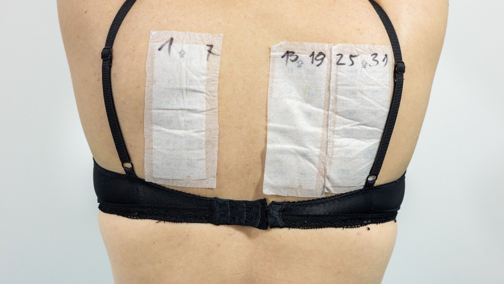 skin patch tests. 