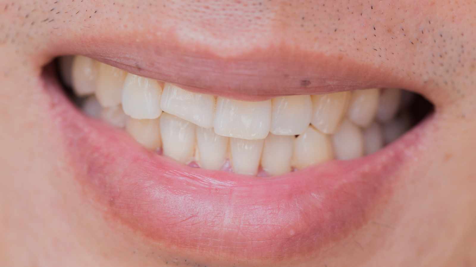 They can damage your teeth