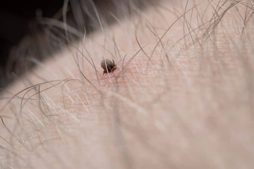 Tick embedded in skin