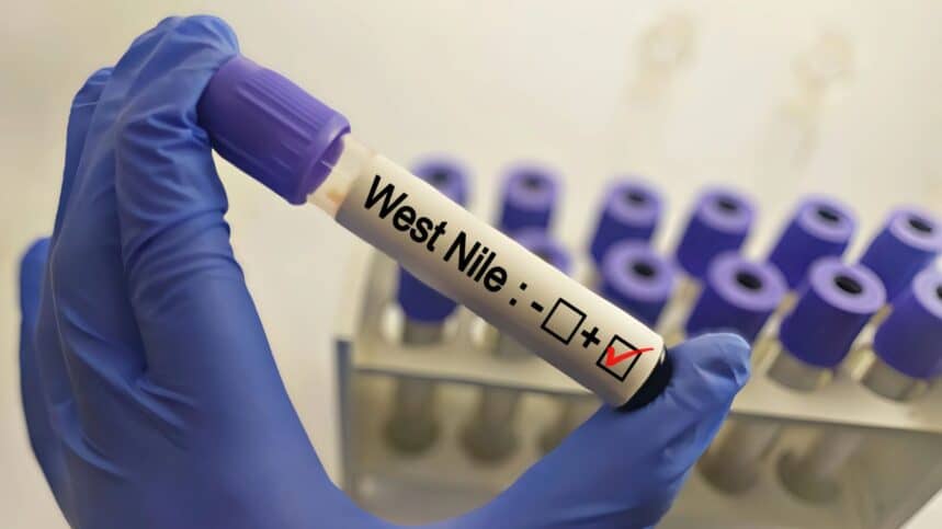 West Nile virus