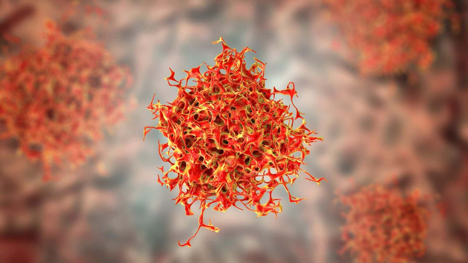 Cancer cell