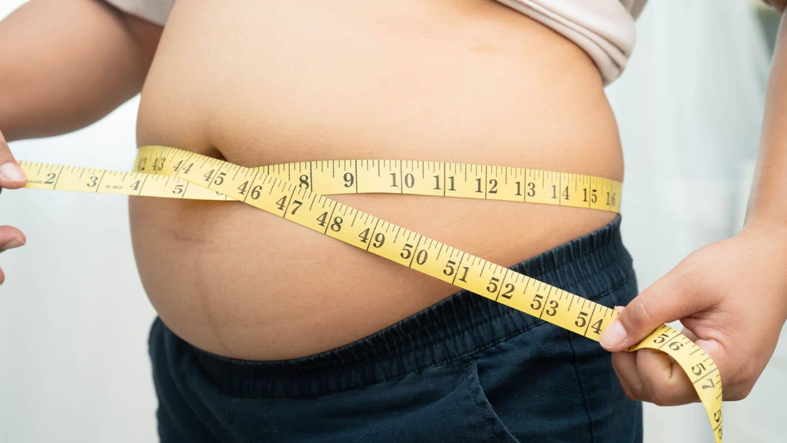 overweight and obesity